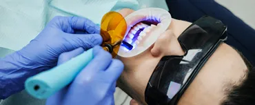 7 Perks of Teeth Whitening | Cosmetic Dentistry | San Francisco