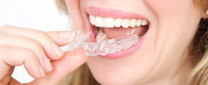 Fix Your TMJ With Invisalign Treatment