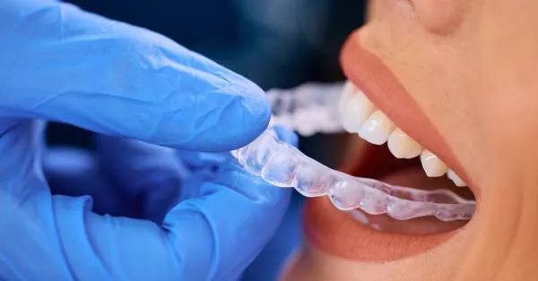 The 6 Health Benefits of Invisalign in San Francisco
